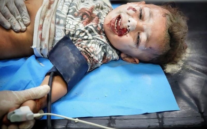 الصحة العالمية: الوضع في غزة يخرج عن السيطرة.. نفقد أرواحًا في كل ثانية . الجمال نيوز